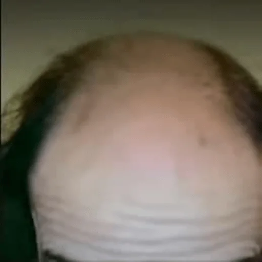 Эмодзи Гельман атакует