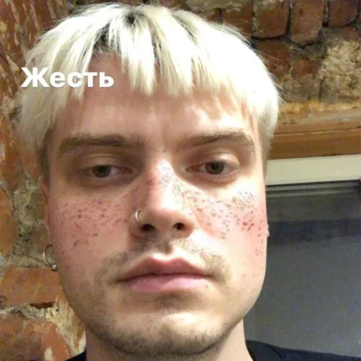 Эмодзи Электрофорез